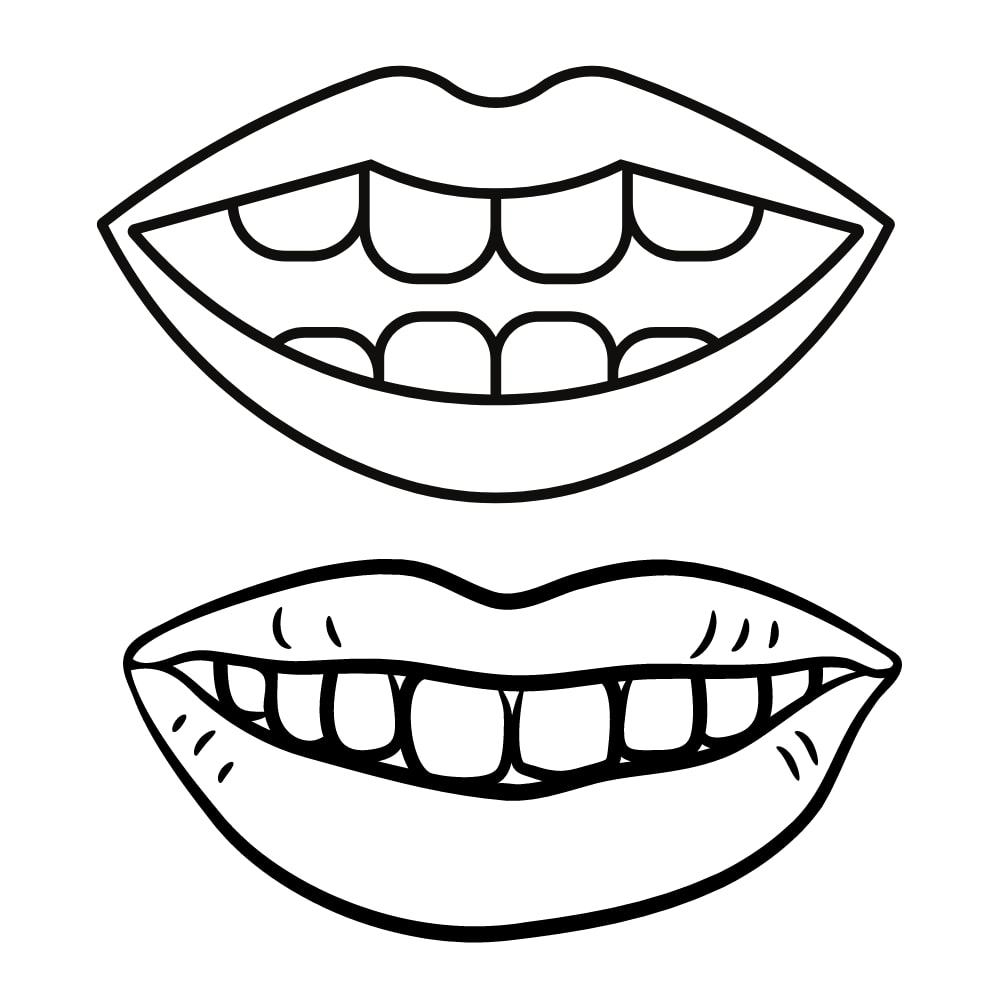 Molde de boca com dentes